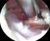 Illustration 26 for J. W. Thomas on Snapping Hip: Causes, Cures & Relief