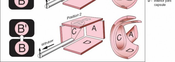 Illustration 202 for Essential Guide: Mastering Every Approach to the Shoulder