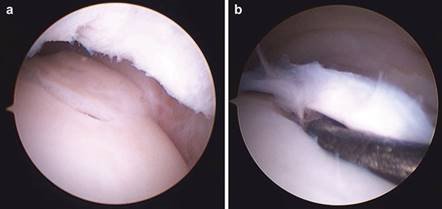 Illustration 28 for First Metatarsal Surgery: Expert Solutions for Foot & Ankle Pain