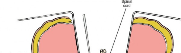 Illustration 188 for Approach to the Lumbar Spine: Mastering Techniques & Anatomy