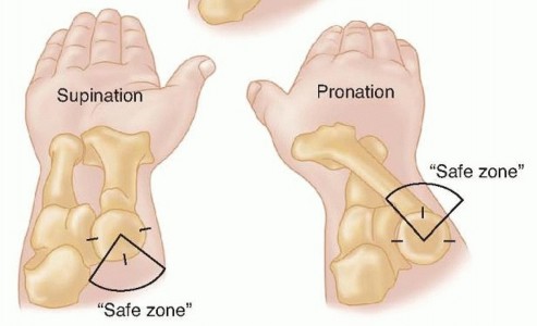 Illustration 24 for Restore Stability & Motion: Fixation of Fracture-Dislocations