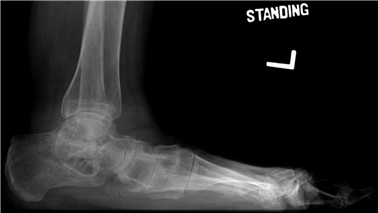 Illustration 14 for First Metatarsal Surgery: Expert Solutions for Foot & Ankle Pain