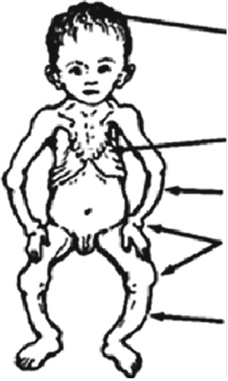 Illustration 18 for Decoding Von Willebrand Factor: Fundamental Basic Science Principles