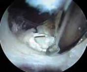 Illustration 28 for J. W. Thomas on Snapping Hip: Causes, Cures & Relief