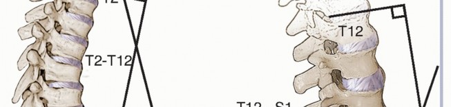 Illustration 15 for Adult Scoliosis: Uncover Causes & Find Lasting Back Pain Relief