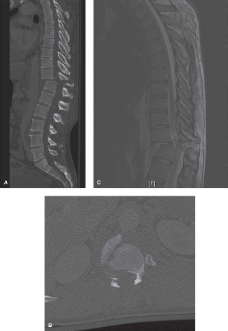Illustration 55 for Master Orthopedic Spine Cases: Sharpen Your Diagnostic Skills