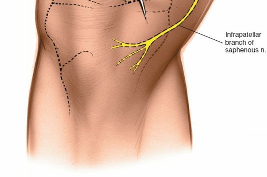 Illustration 48 for Mastering Knee Approaches: Spotlight on Superficial Medial Ligament