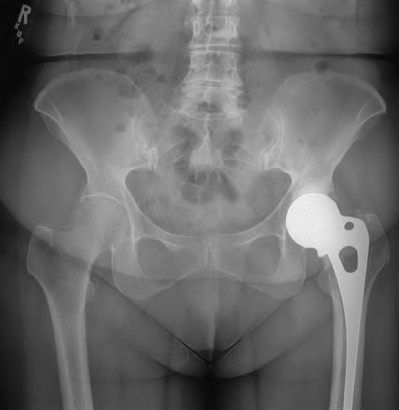 Orthopedic Adult Reconstructiv Review | Dr Hutaif Hip & -...