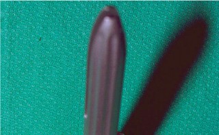 Illustration 29 for The Principles of Revision TKR: Avoid Pitfalls, Ensure Success