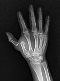 صورة طبية: دليل الأستاذ الدكتور محمد هطيف الشامل لأمراض وإصابات اليد والمعصم في صنعاء