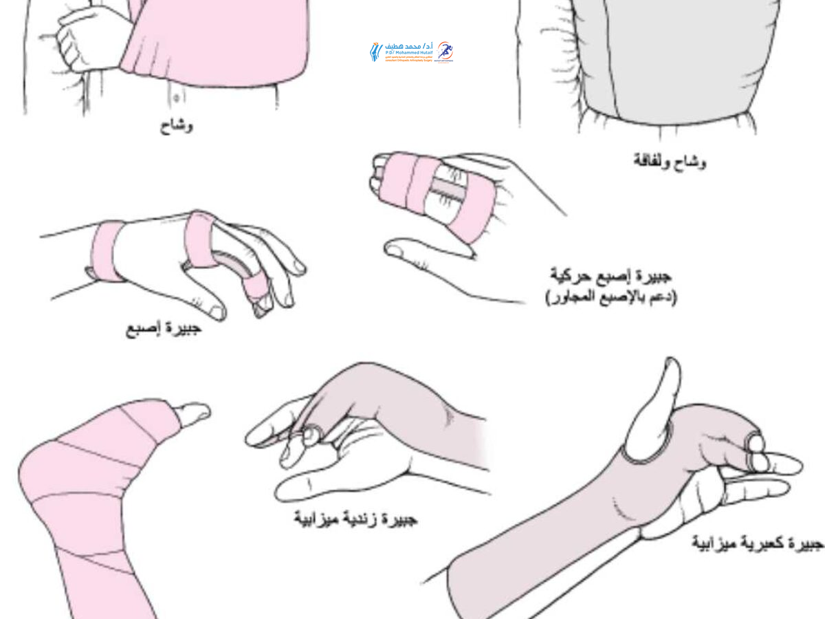 خلع المفصل: الأسباب، الأعراض وعلاج الانخلاع الفعال