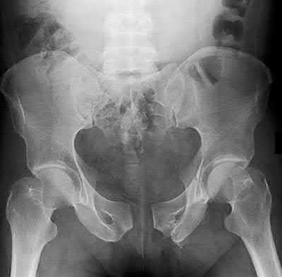 Illustration 70 for OrthoCash: Trauma MCQs & Cases for a yearold woman