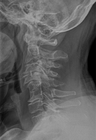 Master Orthopedic Spine Cases: Sharpen Your Diagnostic Skills