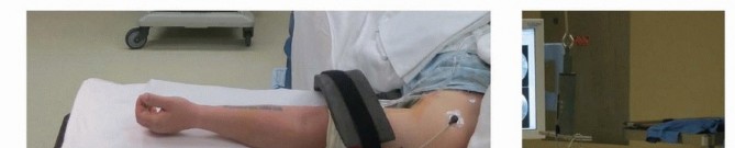 Illustration 17 for Galeazzi DRUJ Stabilization: Unlocking Stability with Smooth Stainless Steel