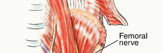 Illustration 4 for Pelvic Metastasis Surgery: A Component of the Utilitarian Approach