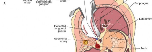Illustration 323 for Approach to the Lumbar Spine: Mastering Techniques & Anatomy