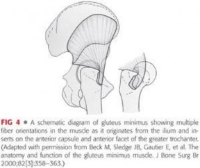 Illustration 21 for Periarticular Arthroscopy: Addressing Medius & Minimus Tears