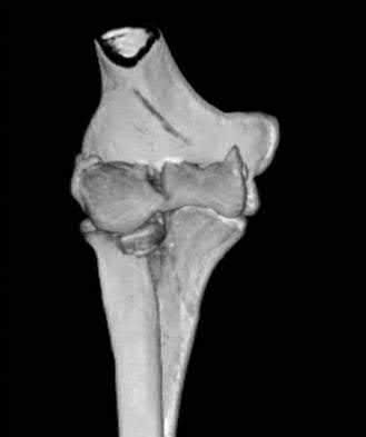 Illustration 33 for OrthoCash: Trauma MCQs & Cases for a yearold woman
