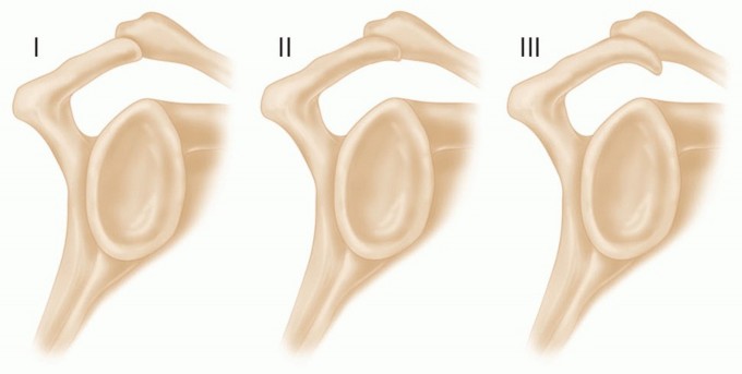 Illustration 4 for The Anatomy of the Shoulder & Elbow: Master Your Body