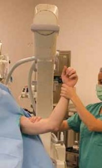 Illustration 8 for Mastering Pediatric Shoulder Fractures: Clinical Insights