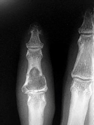 وصف طبي دقيق ومبسط للمريض