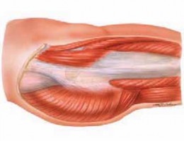 Illustration 2 for J. W. Thomas on Snapping Hip: Causes, Cures & Relief