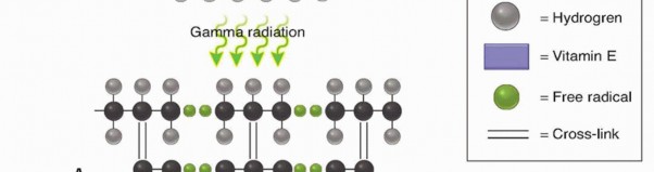 Illustration 9 for Which Bearing Surface Options Are Best for Your Total Hip?