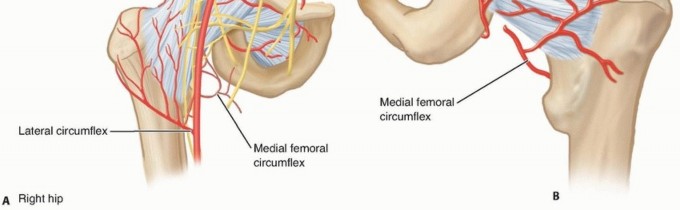 Illustration 2 for Septic Hip in Children: Mastering Anterior Drainage for Optimal Recovery