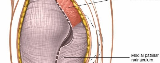 Illustration 33 for Mastering Knee Approaches: Spotlight on Superficial Medial Ligament