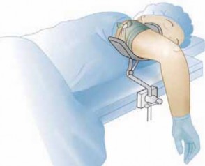 Illustration 8 for Precision Arthroscopy for Chondral Injuries & OCD: Direct Lateral Portal
