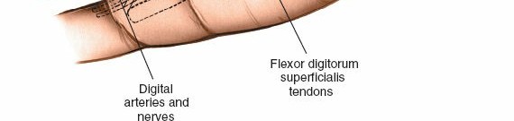 Image illustrating the exploration and irrigation of the deep palmar space