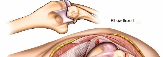 Illustration 21 for Mastering Elbow Approaches: Applied Surgical Anatomy for Precision
