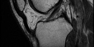 Illustration 5 for Solve Sports Medicine Cases: Uncover Why the Correct Answer Is E