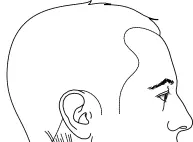 صورة توضيحية لـ جراحات العمود الفقري العنقي: دليل شامل للنهج الأمامي والخلفي وتثبيت الهالو فيست في صنعاء