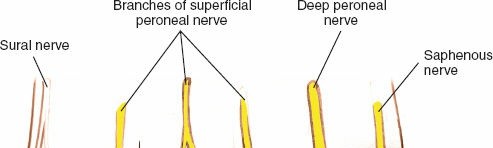 Illustration 221 for Optimized Approaches to the Dorsum of the Foot & Ankle