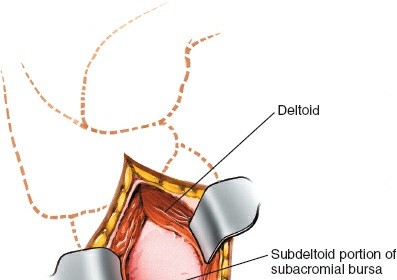 Illustration 105 for Essential Guide: Mastering Every Approach to the Shoulder