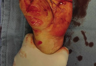 Illustration 2 for Hand Injury Case: Mastering Radial Nerve Diagnosis in the Hand