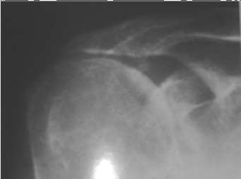 Orthopedic A Review | Dr Hutaif General Orthopedics Rev -...