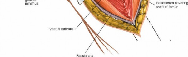 Illustration 57 for Unlocking Every Aspect of the Hip's Surgical Approaches