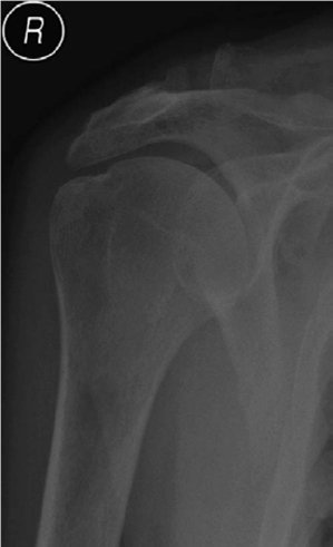 Illustration of elbow structured oral - Dr. Mohammed Hutaif