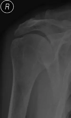 دليلك الشامل لأمراض وإصابات المرفق: العلاج والرعاية مع الأستاذ الدكتور محمد هطيف في صنعاء