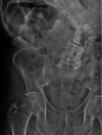 Illustration 14 for Master Orthopedic Spine Cases: Sharpen Your Diagnostic Skills