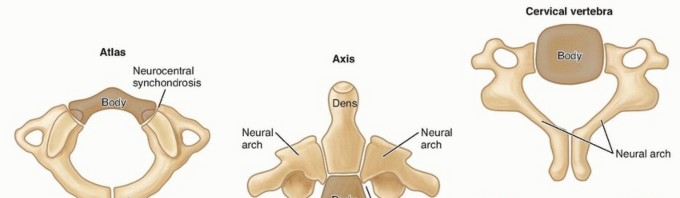 Addressing Cervical Spine Instability with Posterior Arthrodesis
