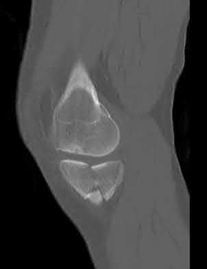 Illustration 186 for OrthoCash: Trauma MCQs & Cases for a yearold woman