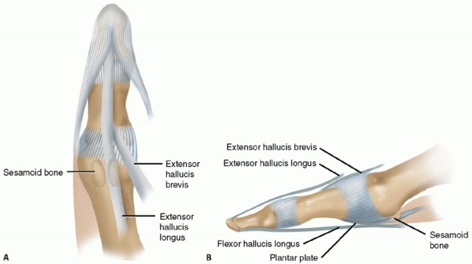 MTP Joint Arthrodesis: The Key to Optimal Toe Positioning