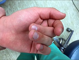 صورة طبية: دليل الأستاذ الدكتور محمد هطيف الشامل لأمراض وإصابات اليد والمعصم في صنعاء