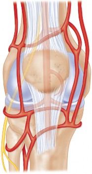 Illustration 13 for PROSTALAC Articulating Spacer: Treat Infected Knees, Regain Mobility
