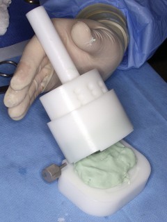 Illustration 26 for PROSTALAC Articulating Spacer: Treat Infected Knees, Regain Mobility