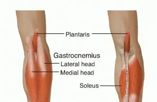 صورة توضيحية لـ تمزق وتر أخيل: دليل شامل للعلاج والتعافي مع الأستاذ الدكتور محمد هطيف