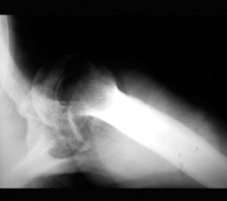Illustration 48 for Acad Orthop Surg Challenge: Diagnose Shoulder Pain Case 1